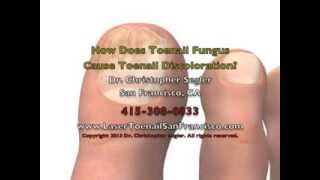 How Does Toenail Fungus Cause Toenail Discoloration