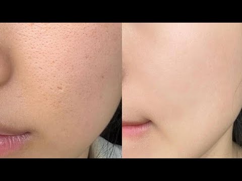 experimental textureless baby skin ⋅˚ ୨୧ deep exfoliation ﹙1X﹚