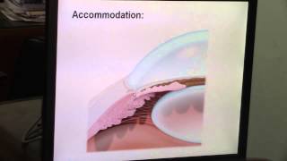 [Vision] - Accomodation .Dr.Hany Gamal