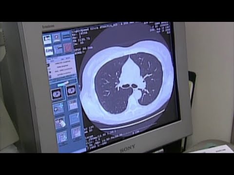 Cancer Cases Increase