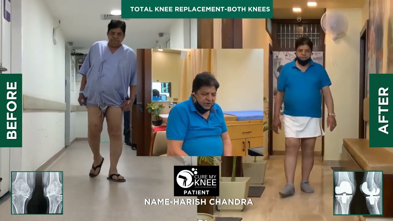 video of spine surgery in Delhi performed by Dr DK Das