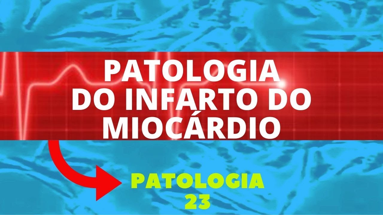 INFARTO DO MIOCÁRDIO - PATOLOGIA 23