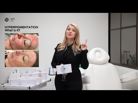 HYPERPIGMENTATION: It’s Not Just a Spot | Explained by Dr. Maria Fedchuk