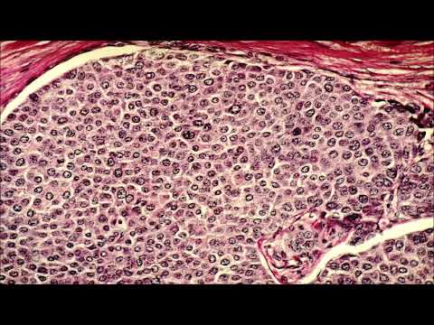 This sound could kill cancer cells (444 Hz) - 120 minutes (2 hours) of possible treatment