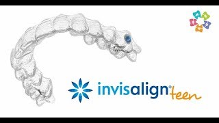 Affordable Invisalign Braces for Teens