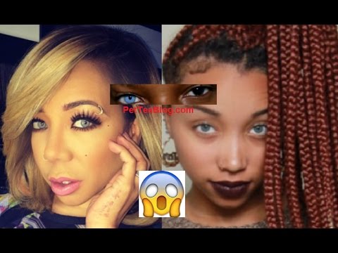 Tiny Harris afraid of going BLIND from Eye Color Surgery didn't want Zonnique FOLLOWING her 😨