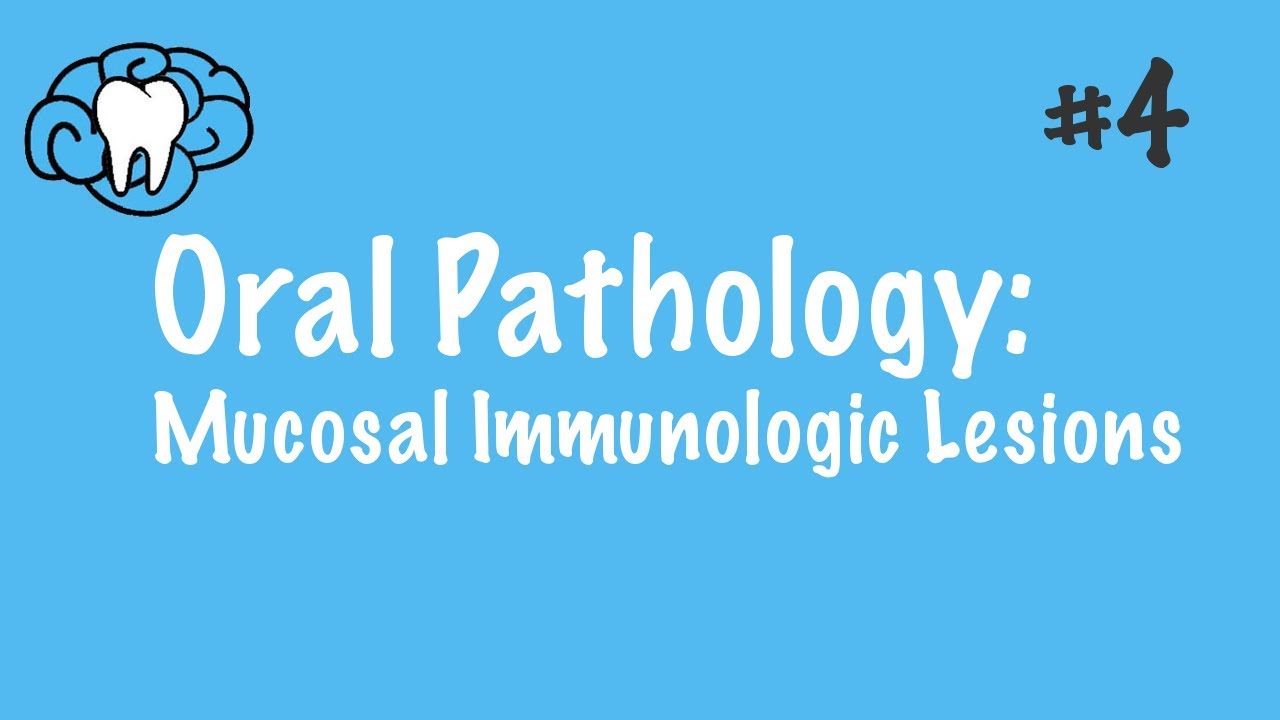 Oral Pathology | Mucosal Immunologic Diseases | INBDE, ADAT
