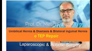 Miniaturka - eTEP Repair. Umbilical & Bilateral İnguinal Hernia. Metin Ertem MD.FACS