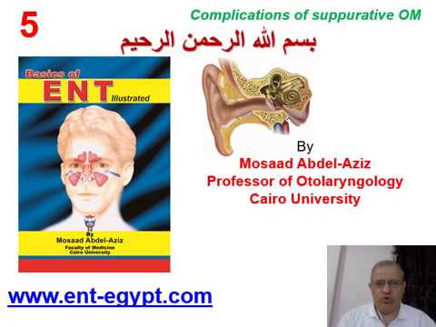 Ear 5 (Mosaad Abdel-Aziz): Complications of Suppurative Otitis Media
