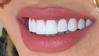 Download lagu Wanita Idaman,Manis nya Cewek Gigi Putih mp3