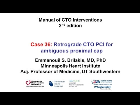 Case 36: Manual of  CTO Interventions - Dual retrograde for proximal cap ambiguity