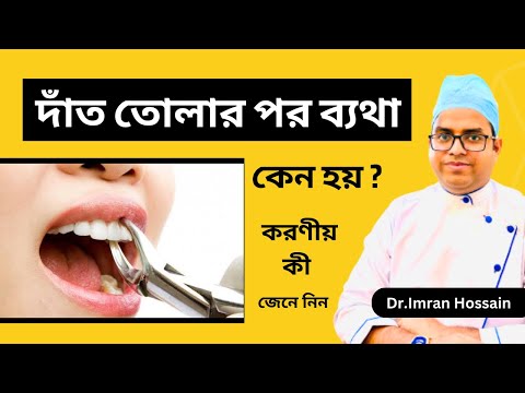দাঁত তোলার পর ব্যথা হয় কেন | tooth extraction pain | Dr. Imran Hossain | Dental View | Banani
