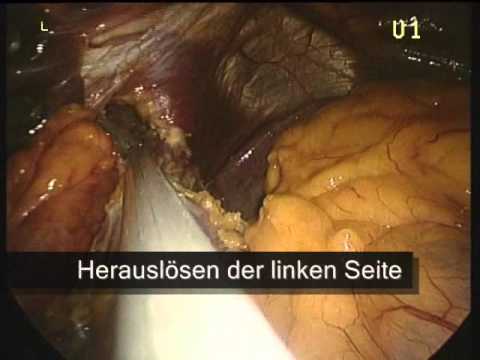 Vorbereitungen für die Wiederherstellung von Gelenkknorpel für Hunde Apfelessig Behandlung von Gelenken