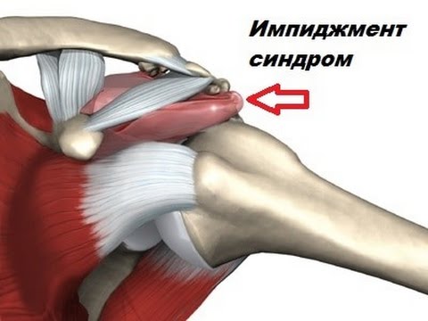 Где пройти обследование коленных суставов Боли внизу спины отдает в ноги