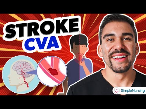 Short Stroke CVA Video