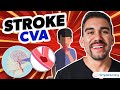 Stroke CVA (Cerebrovascular Accident) Hemorrhagic, Ischemic NCLEX RN & LPN NURSING