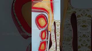 How sinusitis surgery is performed #drone #theflash
