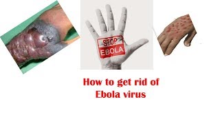 how to get rid of ebola | symptoms & recovery