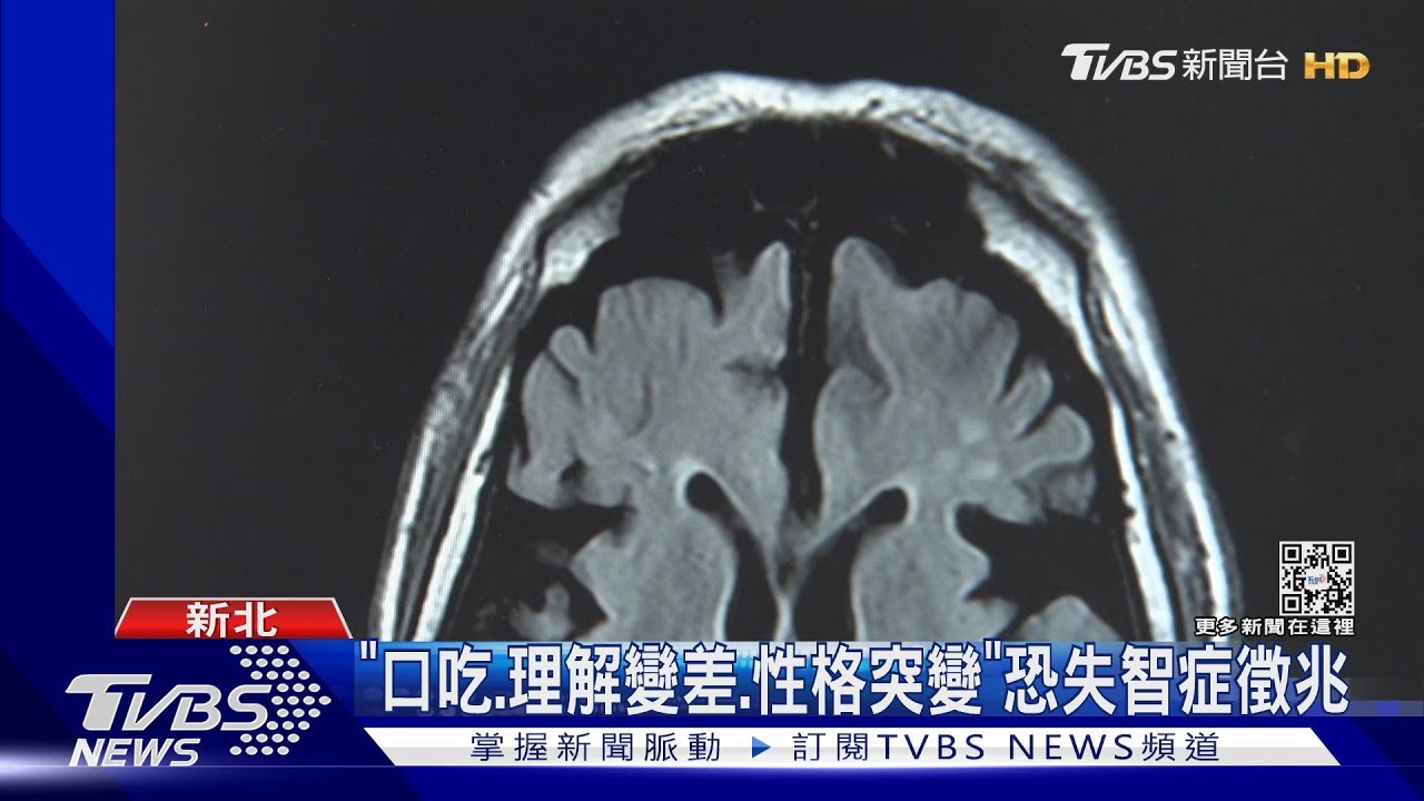 額顳葉失智症「易衝動、失語」 醫:無藥治難照顧
