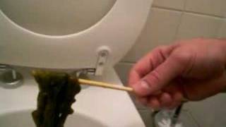 mucous.colon cleanse,mucoid plaque