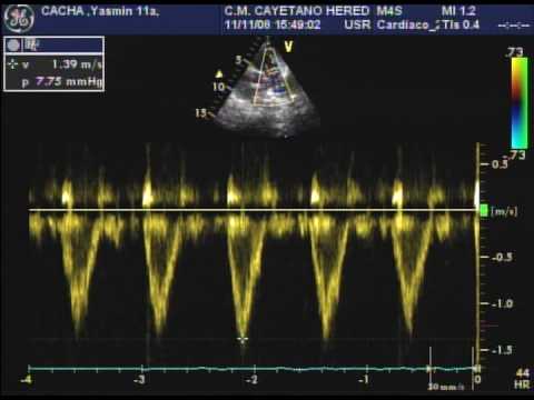 CIA Pac. CACHA PALMA, YASMIN11a
