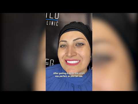 Affordable Smile Makeovers in Istanbul, Turkey – What You’ll Pay and Get