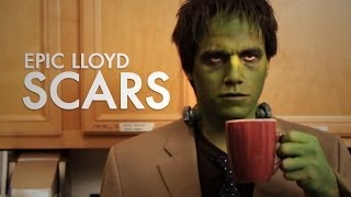 Scars - EpicLLOYD ft. Nice Peter