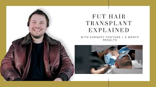Canadian Hair Transplant Centre