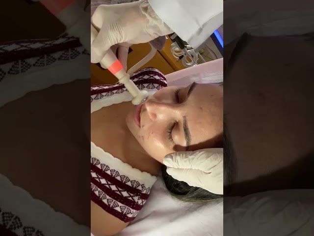 Vídeo