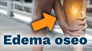 Tratamiento efectivo para EDEMA OSEO con magnetoterapia