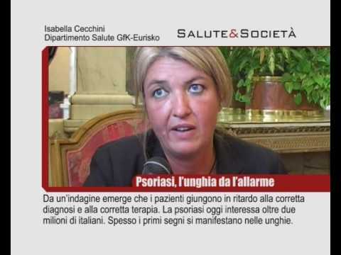 Prevenzione di dermatite atopic ad adulti Se è il carbonio assorbente possibile a dermatite atopic