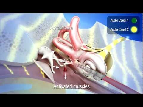 download lagu mp3 mp4 Tomatis, download mp3 Tomatis free download mp3, download mp3 Tomatis