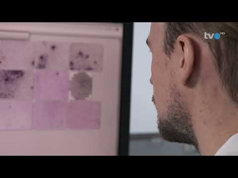 12.12.2022 TVO-Beitrag Gesundheit (ZLM)