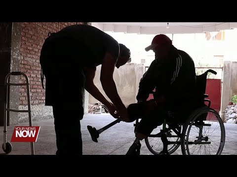 Project Elevenfive providing prosthetic care to individuals in underserved areas of the world