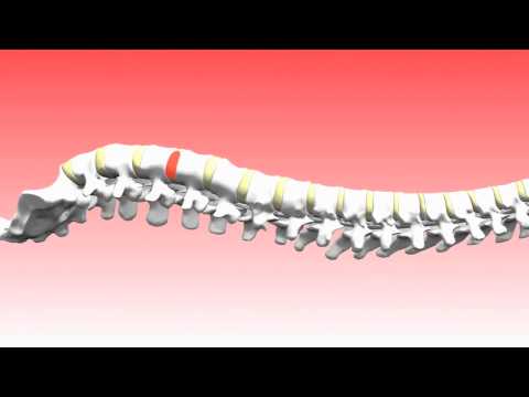 image-What is the DRS protocol?