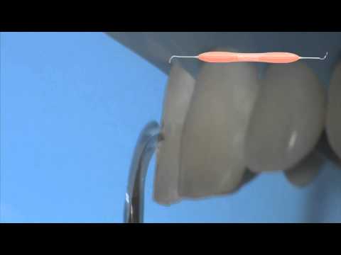 LM-Arte Eccesso (LM 307-308 XSI), Інструмент для видалення надлишків композиту, LM-Dental - фото 1 - id-p2909803847