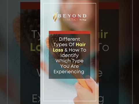 Types of Hair Loss &amp; Their Details