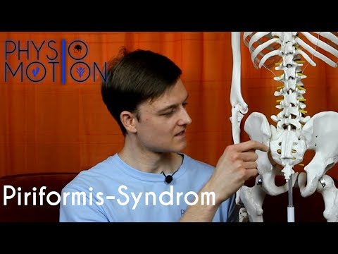 Erklärung des Piriformis-Syndrom's [Physio&Motion] #10