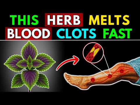 Top Herbs That Dissolve Deadly Blood Clots in Your Legs
