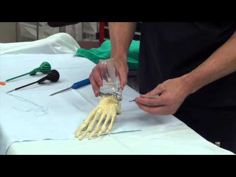 Ask Dr Moore Foot and Ankle FAQ Frequently Asked Questions Video Offering