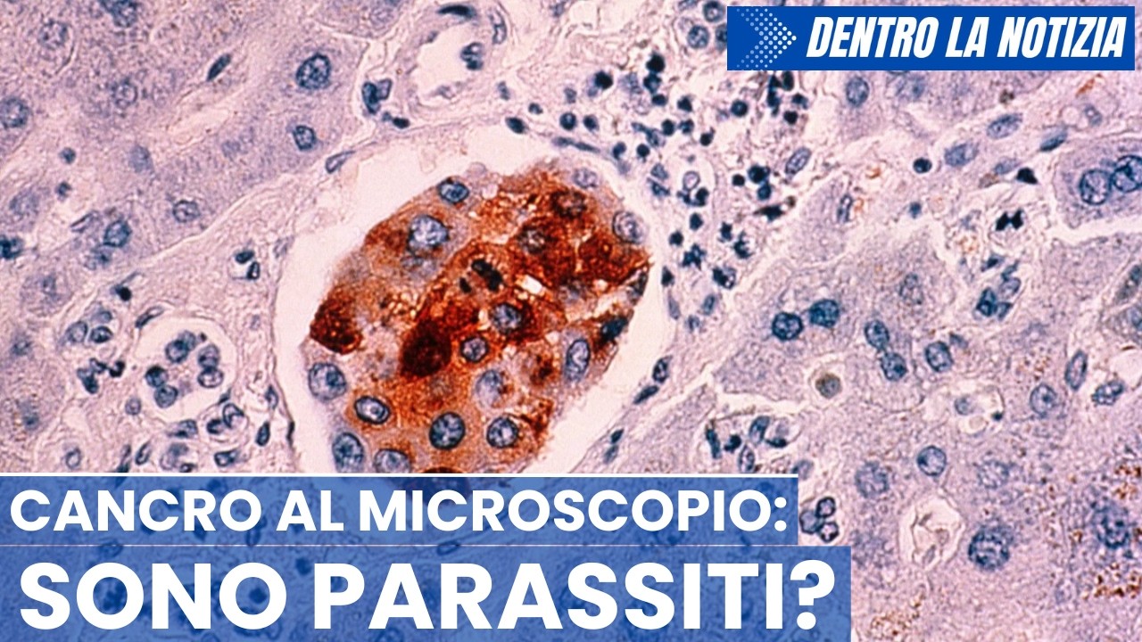 CANCRO al microscopio: le “cellule tumorali” sembrano identiche a gruppi di parassiti e SI MUOVONO!