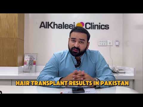 Hair transplant results in Pakistan - AlKhaleej Clinics Karachi