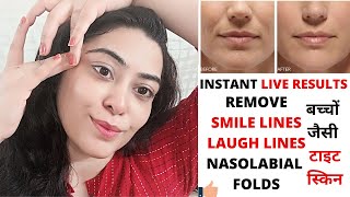 Wrinkle free skin 40 year old look 25 no wrinkles glass skin Get Rid Of Laugh Lines Nasolabial Folds