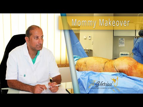 Vidéo Mommy Makeover