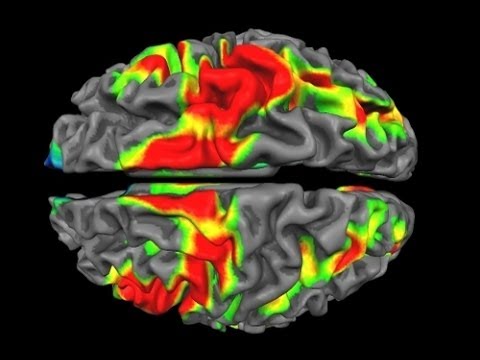Neuroimaging