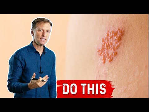 Do You Have Copper Toxicity