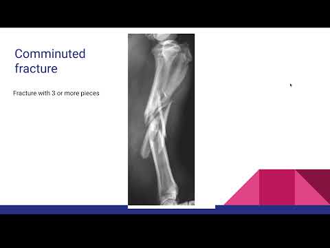 Fractures Introduction and Salter Harris classification for med student