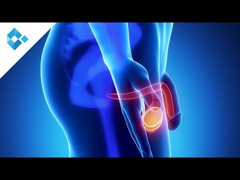 Prostatitis crónica abacteriana tratamiento natural