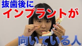 抜歯のあとにインプラントが向いている人