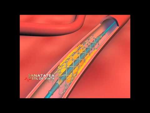 download lagu mp3 mp4 Sanador Preturi Cardiologie, download lagu Sanador Preturi Cardiologie gratis, unduh video klip Sanador Preturi Cardiologie